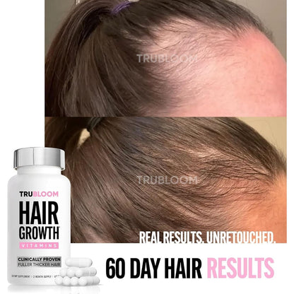 Natural Hair Growth Supplements for Thicker Hair
