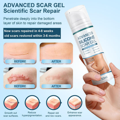 Effective Silicone Scar Cream 50ml - Fade Scars