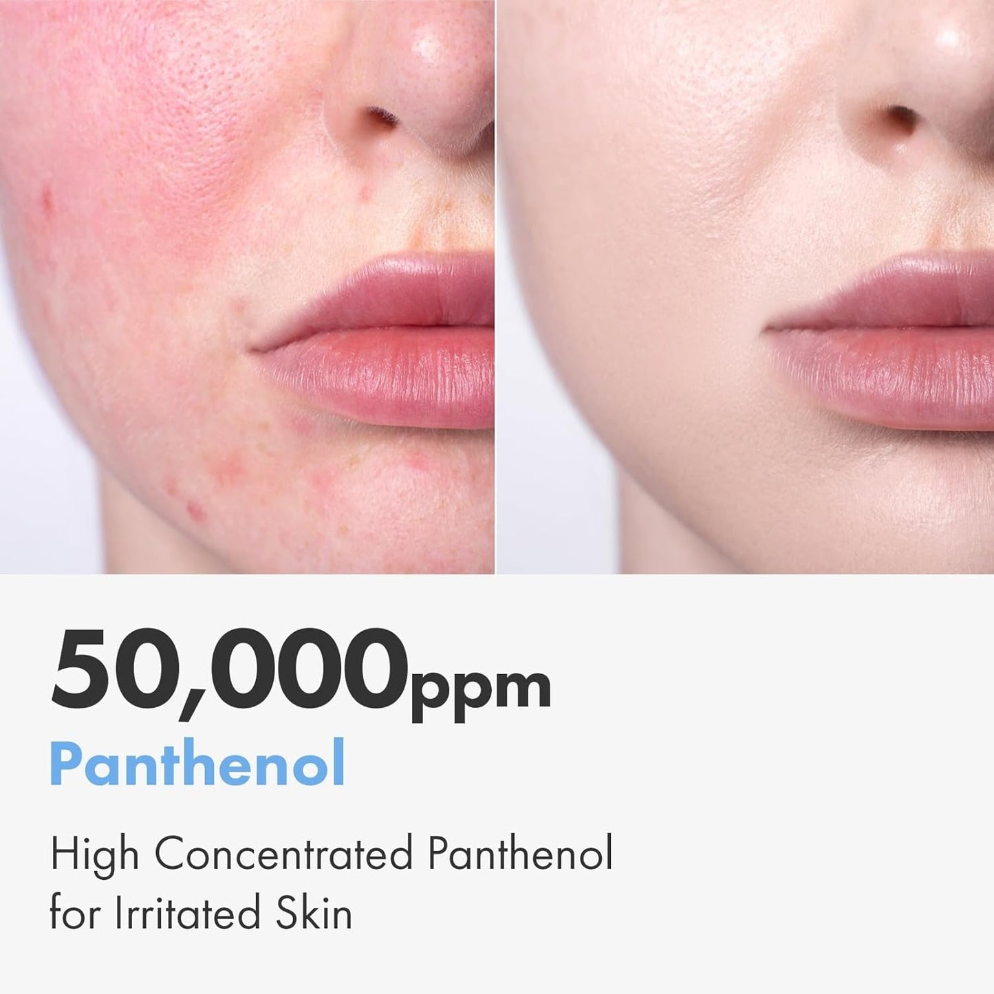 Gentle Moisturizing Cream for Dry Sensitive Skin