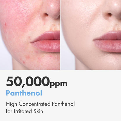 Gentle Moisturizing Cream for Dry Sensitive Skin
