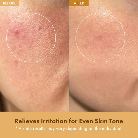 TOSOWOONG Nourishing Rice Moisturizer 50ml Intense Hydrating Cream