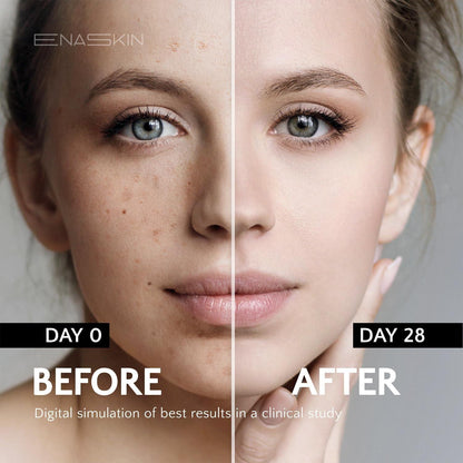 Natural Spot Remover Face Serum - 30ml Brightening Skin Tone