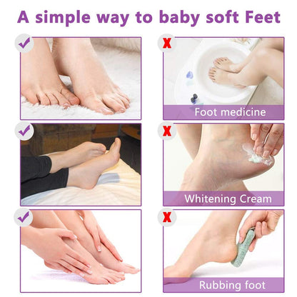 Gentle Exfoliating Foot Mask 5 Pack - Softens Rough Feet