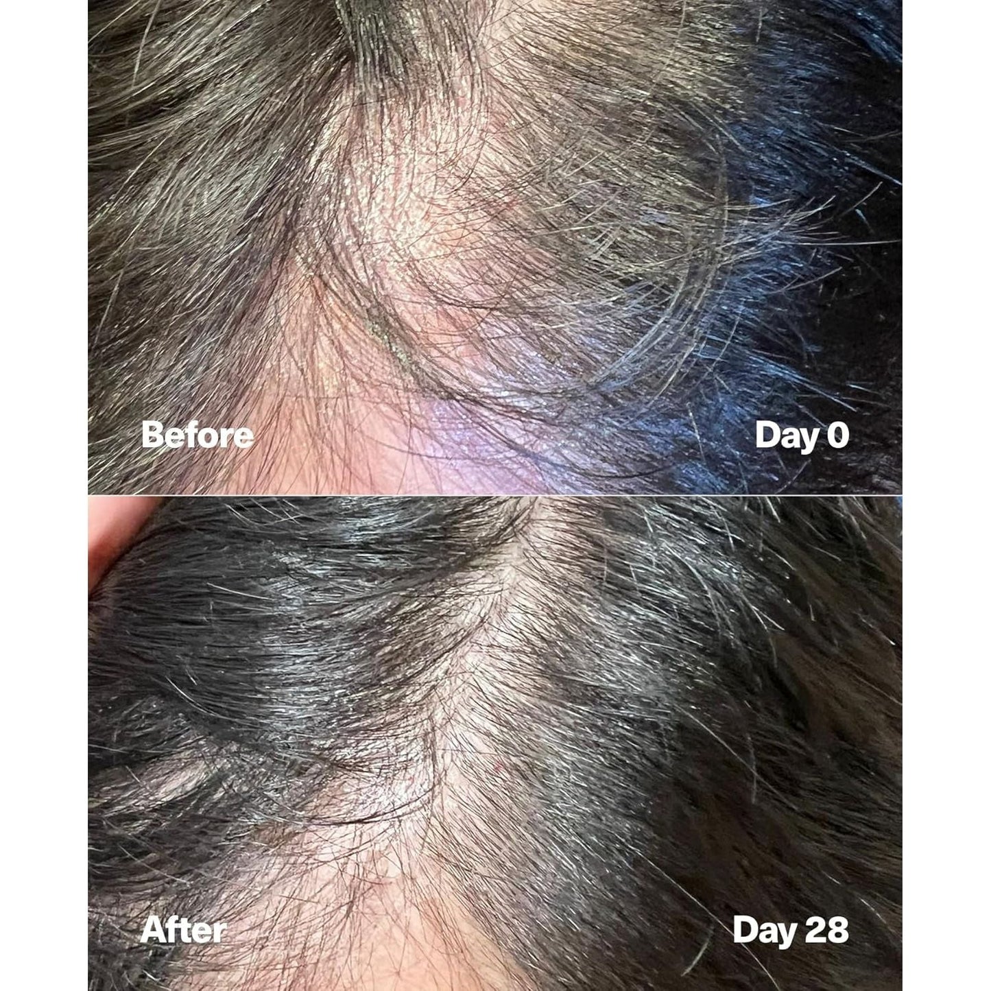 Nourishing Hair Growth Serum for Thicker Hair - 60ml