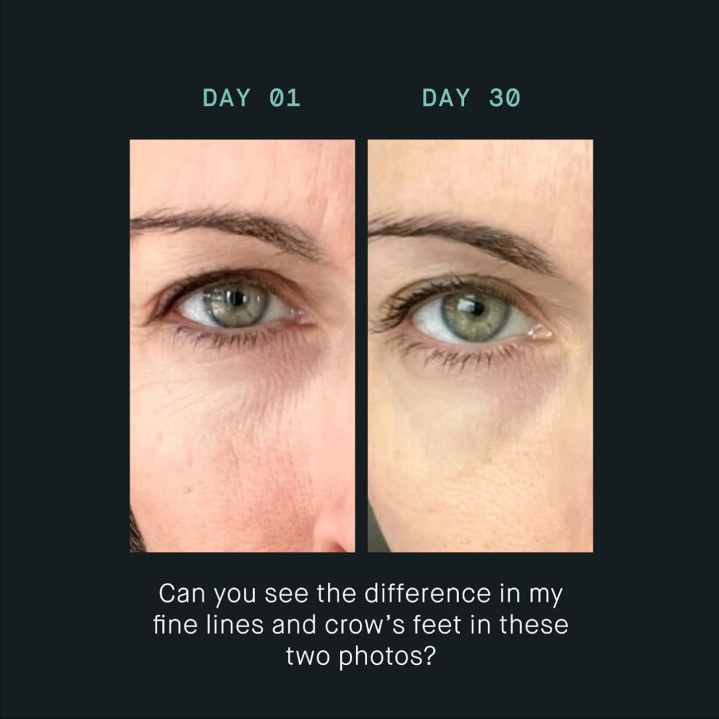 Anti Aging Eye Cream for Fine Lines and Wrinkles