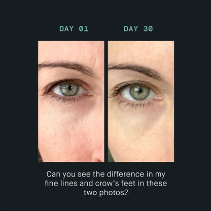 Anti Aging Eye Cream for Fine Lines and Wrinkles