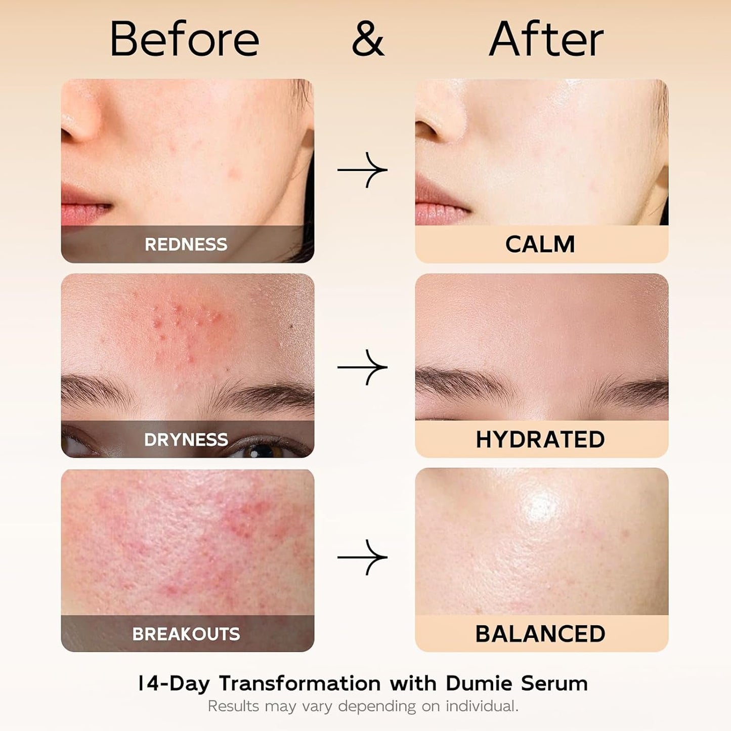 Gentle Azelaic Acid Calming Face Serum 30ml