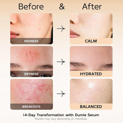 Gentle Azelaic Acid Calming Face Serum 30ml