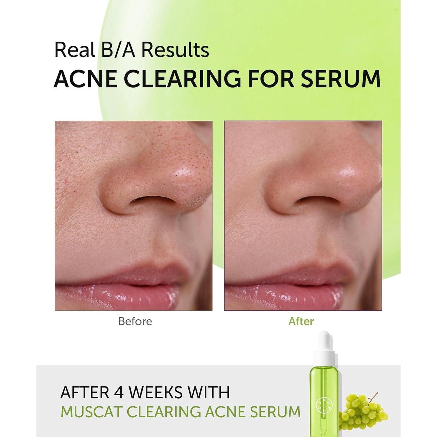 Brightening Serum for Flawless Skin Tone