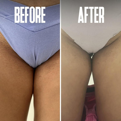 Soothing Ingrown Hair Removal Pads