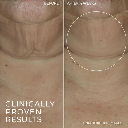 Anti Aging Face Serum Stick with Retinol