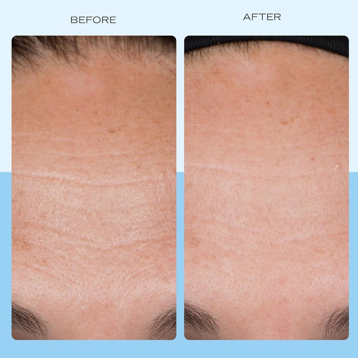 Anti Aging Face Cream - 104ml | Hydrating Collagen Moisturizer