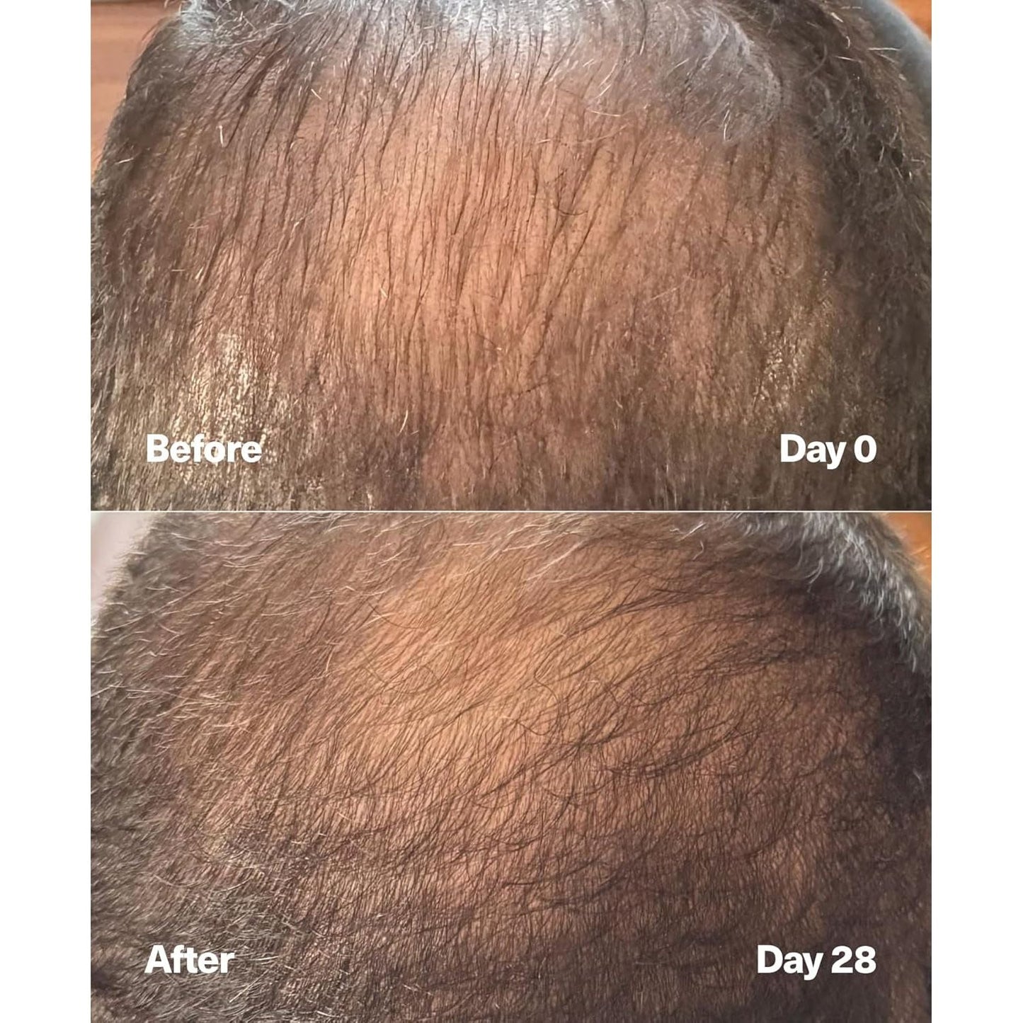 Nourishing Hair Growth Serum for Thicker Hair - 60ml