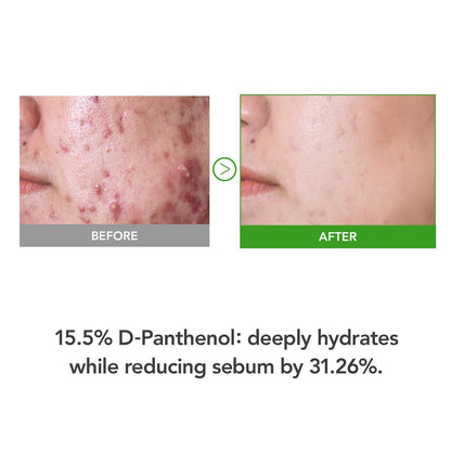 Intensive Moisturizing D-Panthenol Cream 35ml