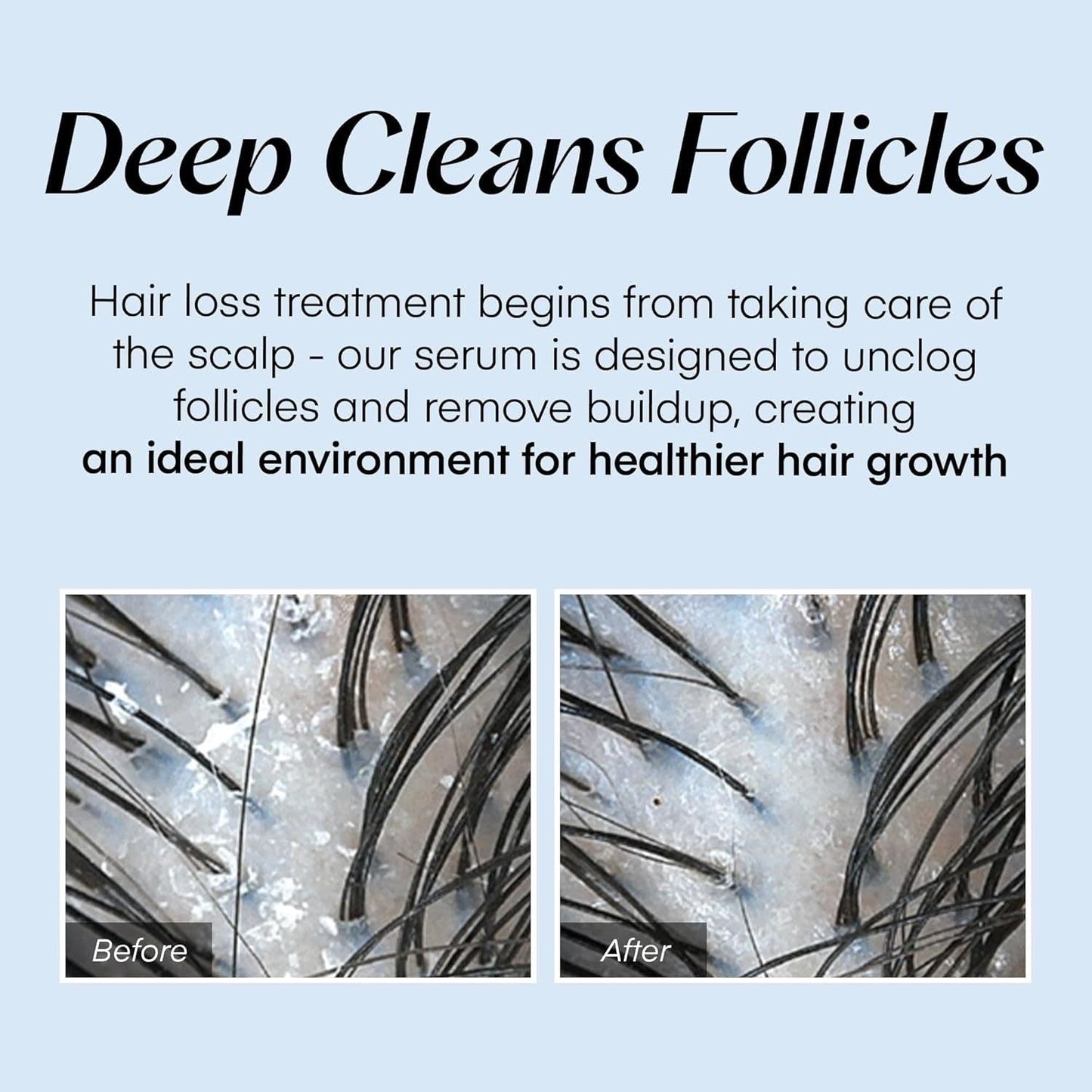 Natural Hair Growth Serum 20ml