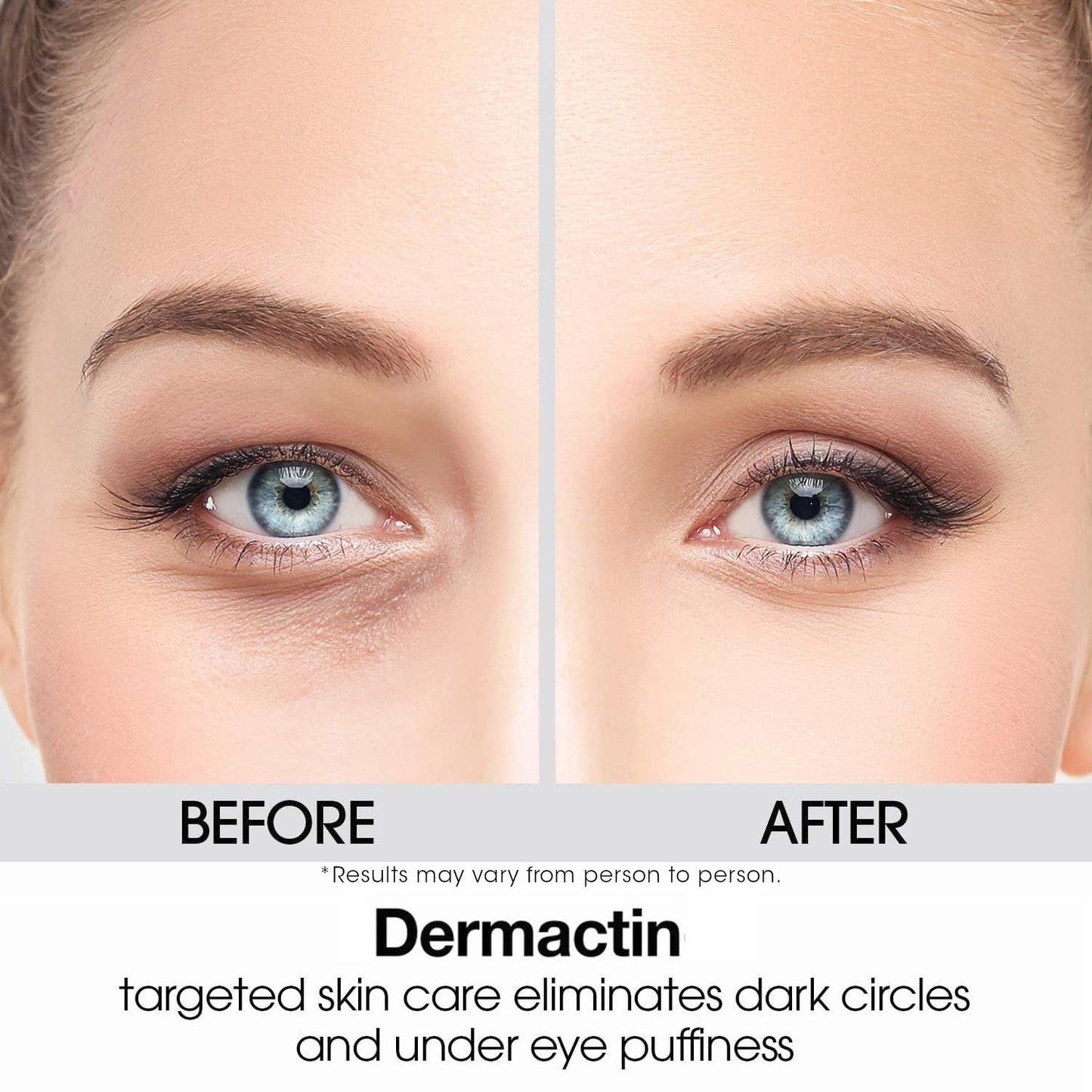 Firming Upper Eyelid Cream for Sagging Lids