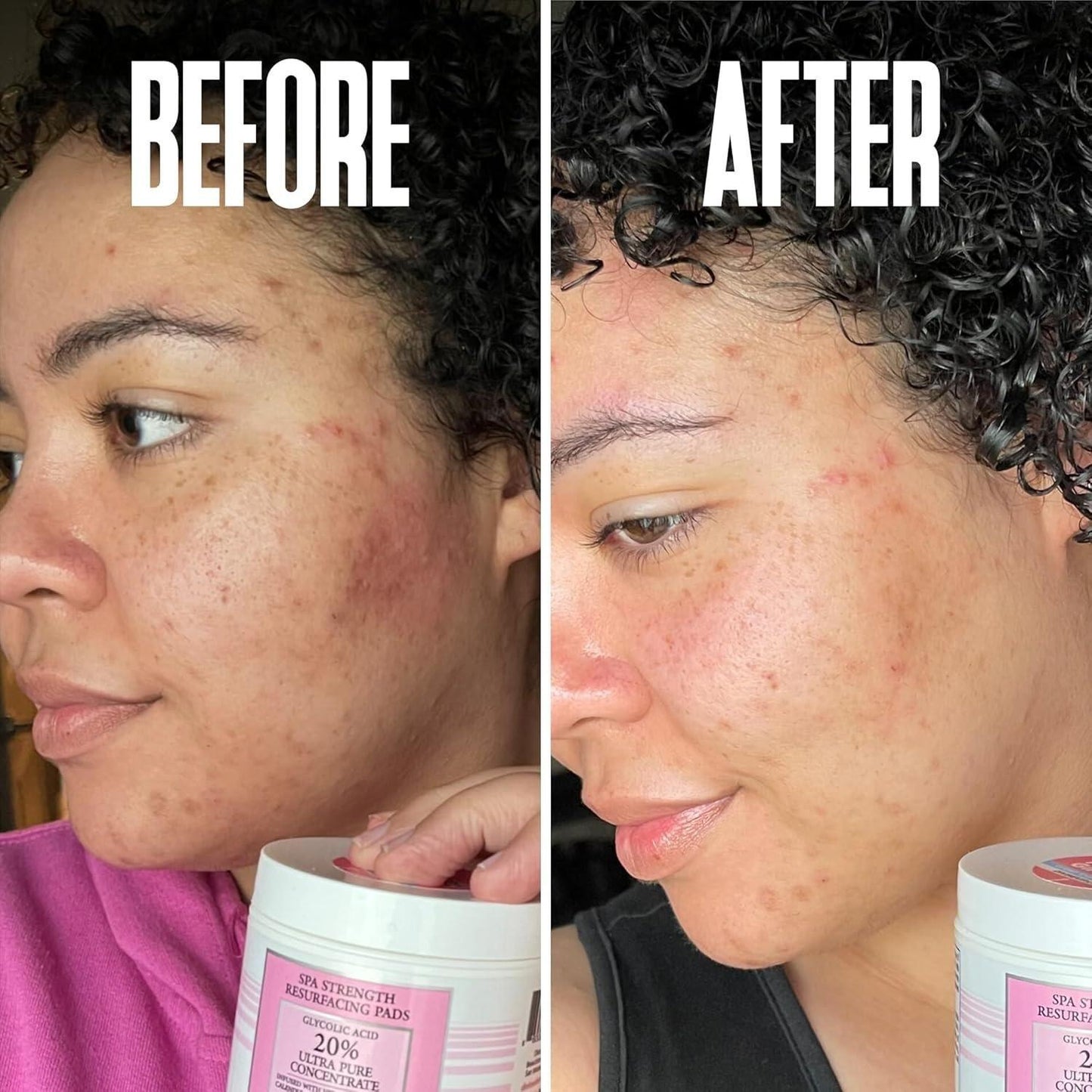 Gentle Skin Exfoliating Pads with Glycolic Acid