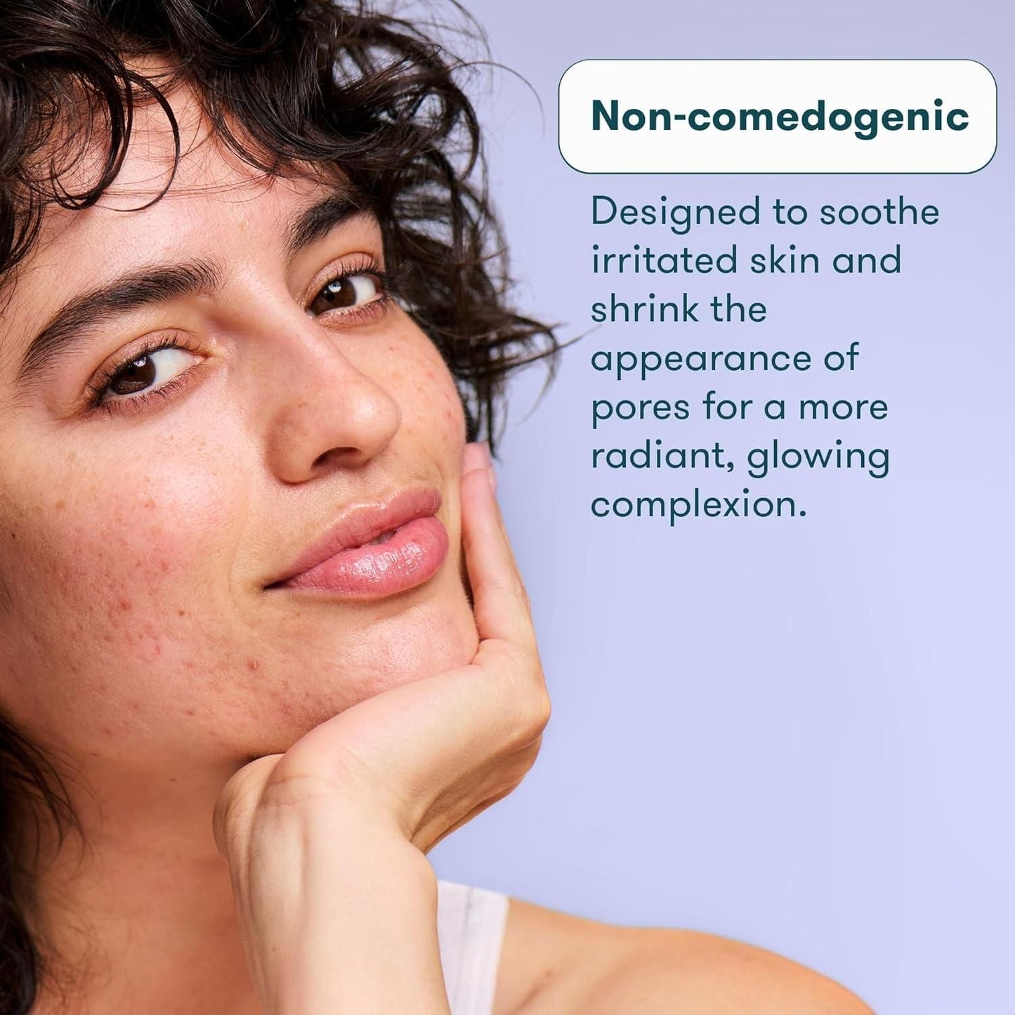 Effective Blackhead Remover Acne Treatment Gel