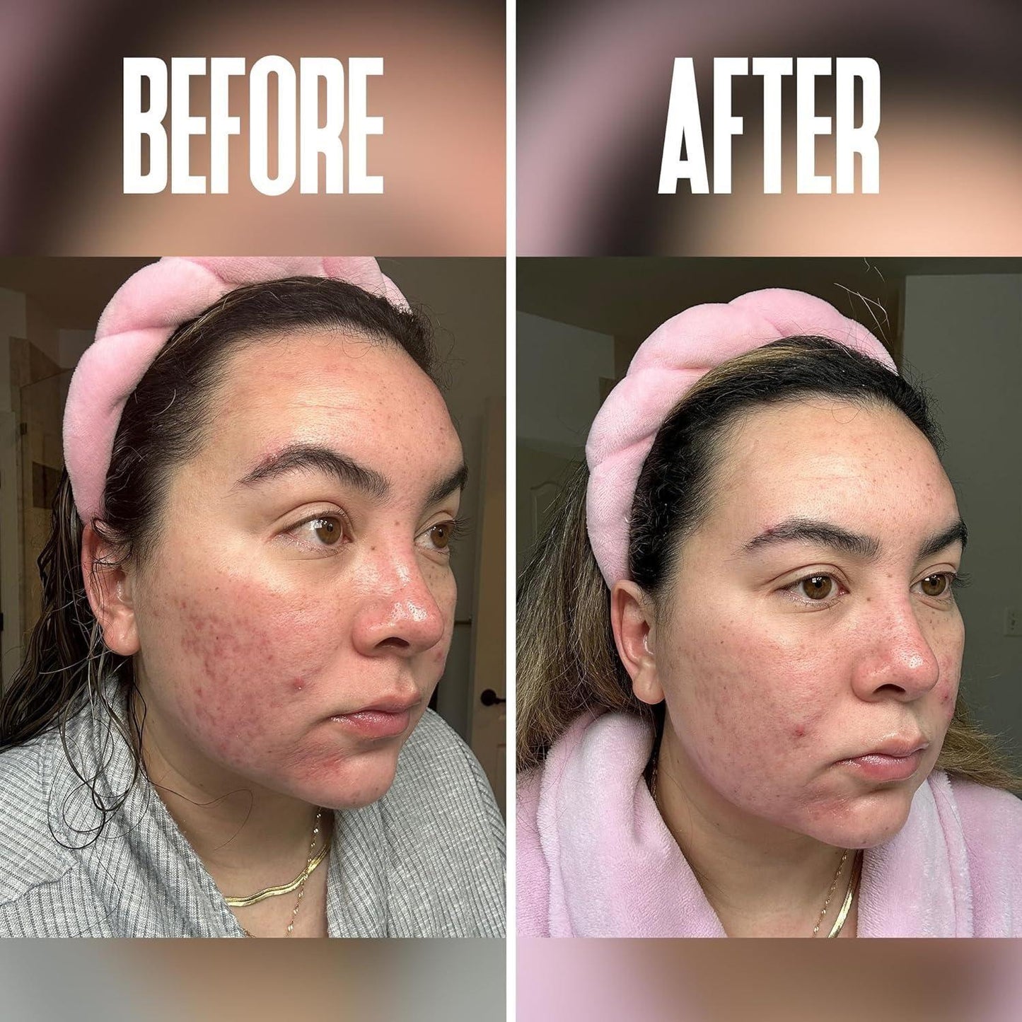 Gentle Skin Exfoliating Pads with Glycolic Acid