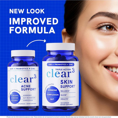 Natural Acne Relief Supplement - 120 Capsules