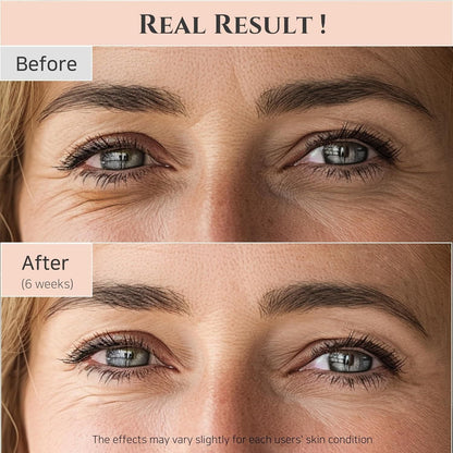 Anti Aging Eye Serum with Ginseng and Retinol 30ml