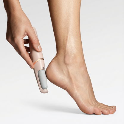 Rechargeable Electric Foot Callus Remover for Smoother Feet