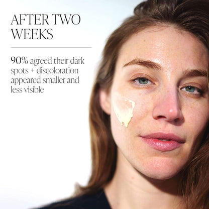 Natural Dark Spot Reducing Moisturizing Cream