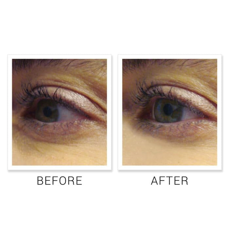 Anti Aging Eye Cream Reduces Dark Circles