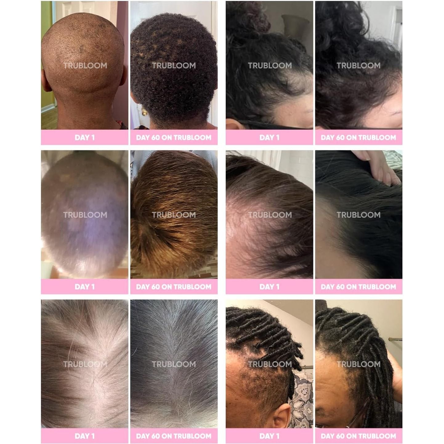 Natural Hair Growth Supplements for Thicker Hair