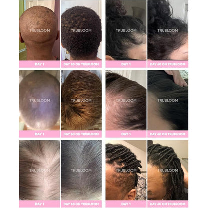 Natural Hair Growth Supplements for Thicker Hair