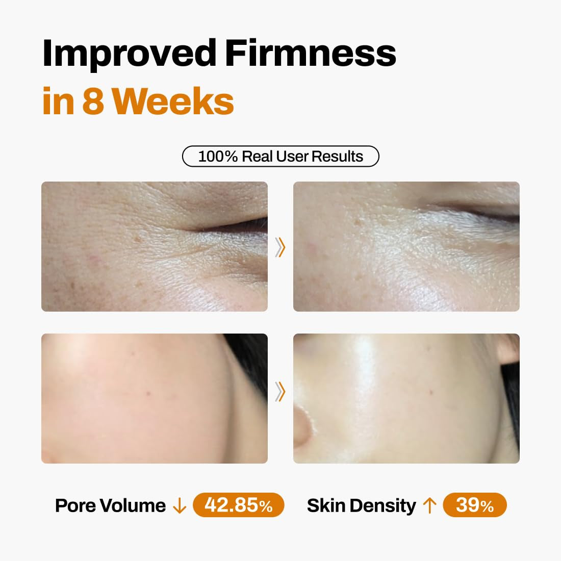 Advanced Anti Aging Skin Lift Kit