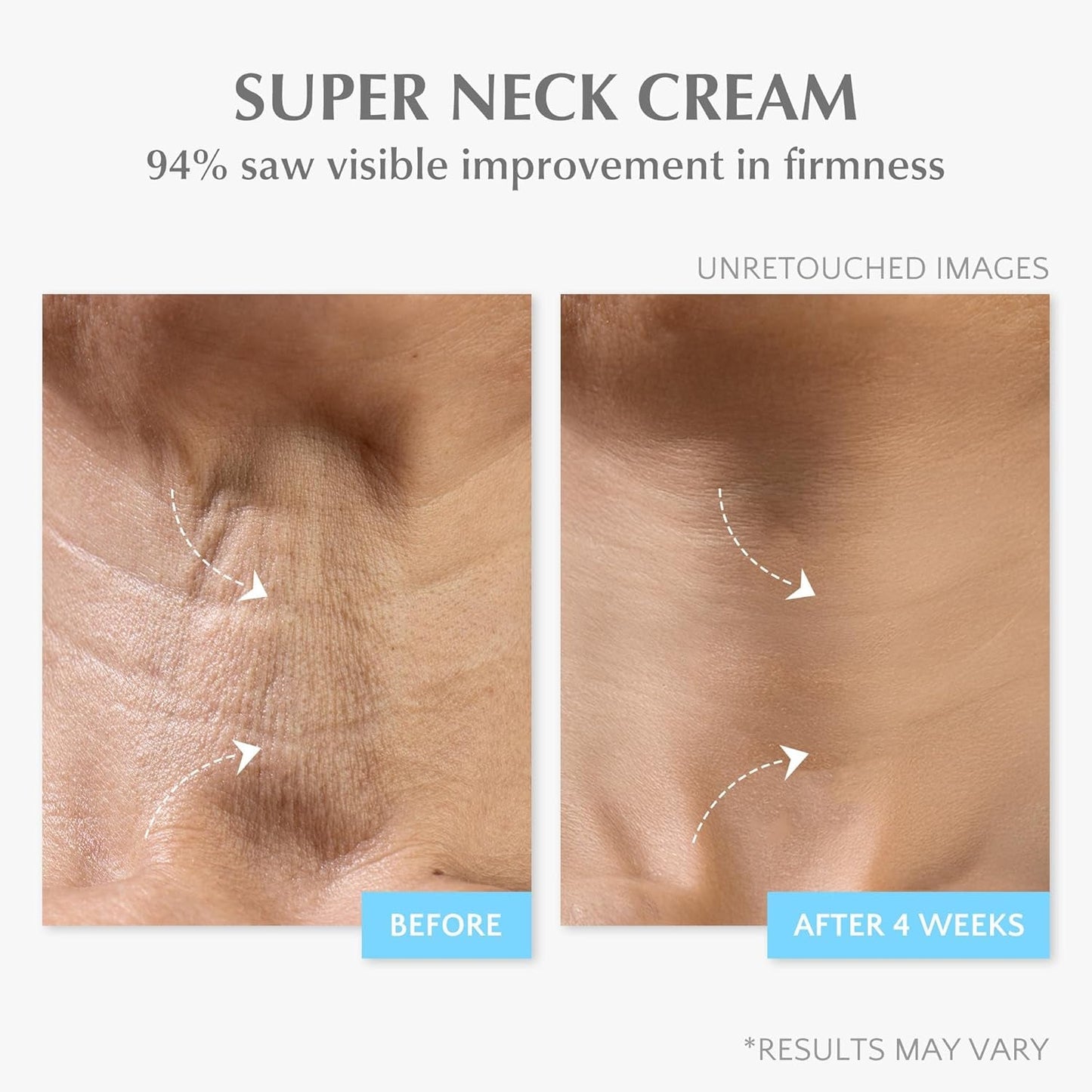 Anti Aging Moisturizing Face Cream with Retinol