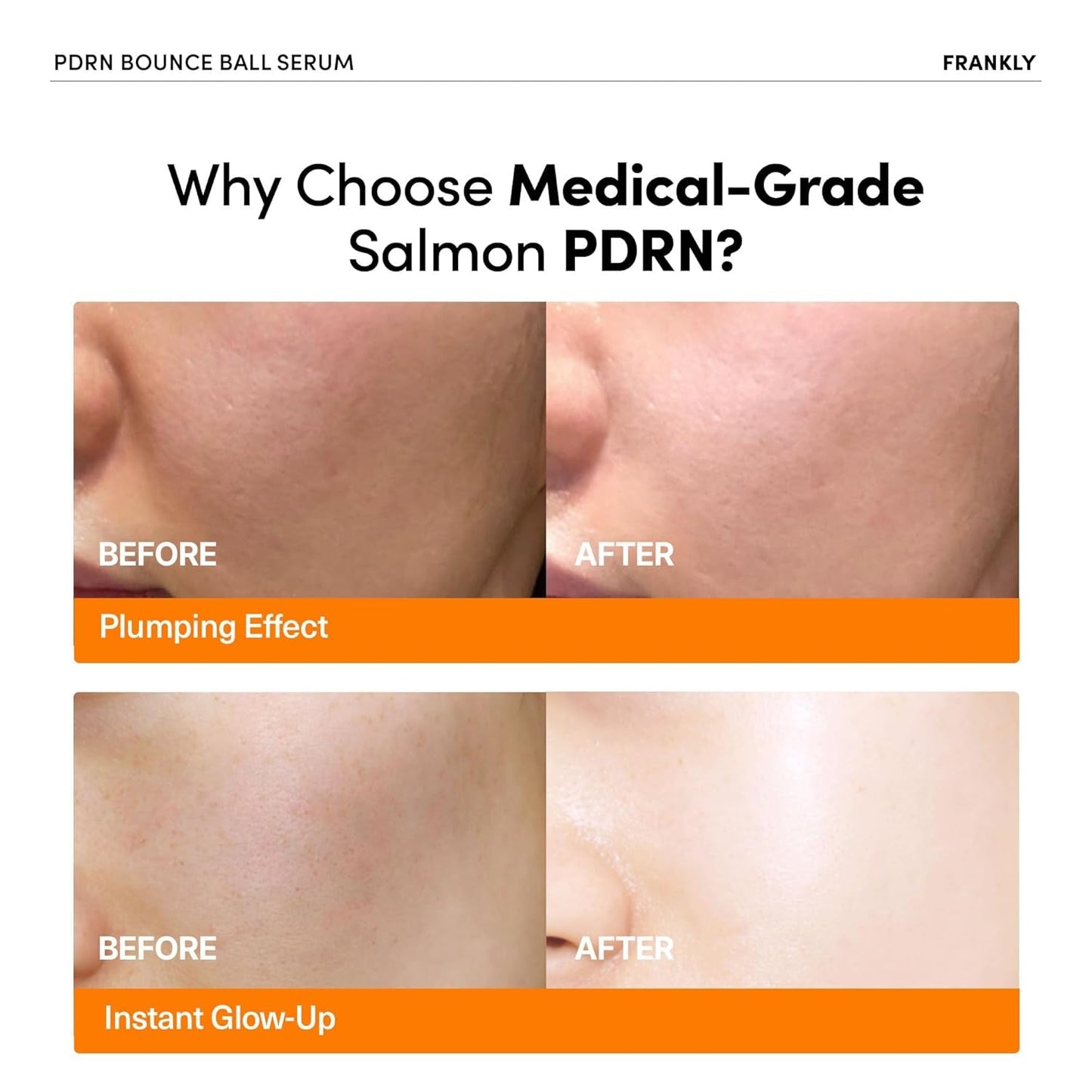 Anti Aging Face Serum 30ml | Firming Plumping Collagen Booster