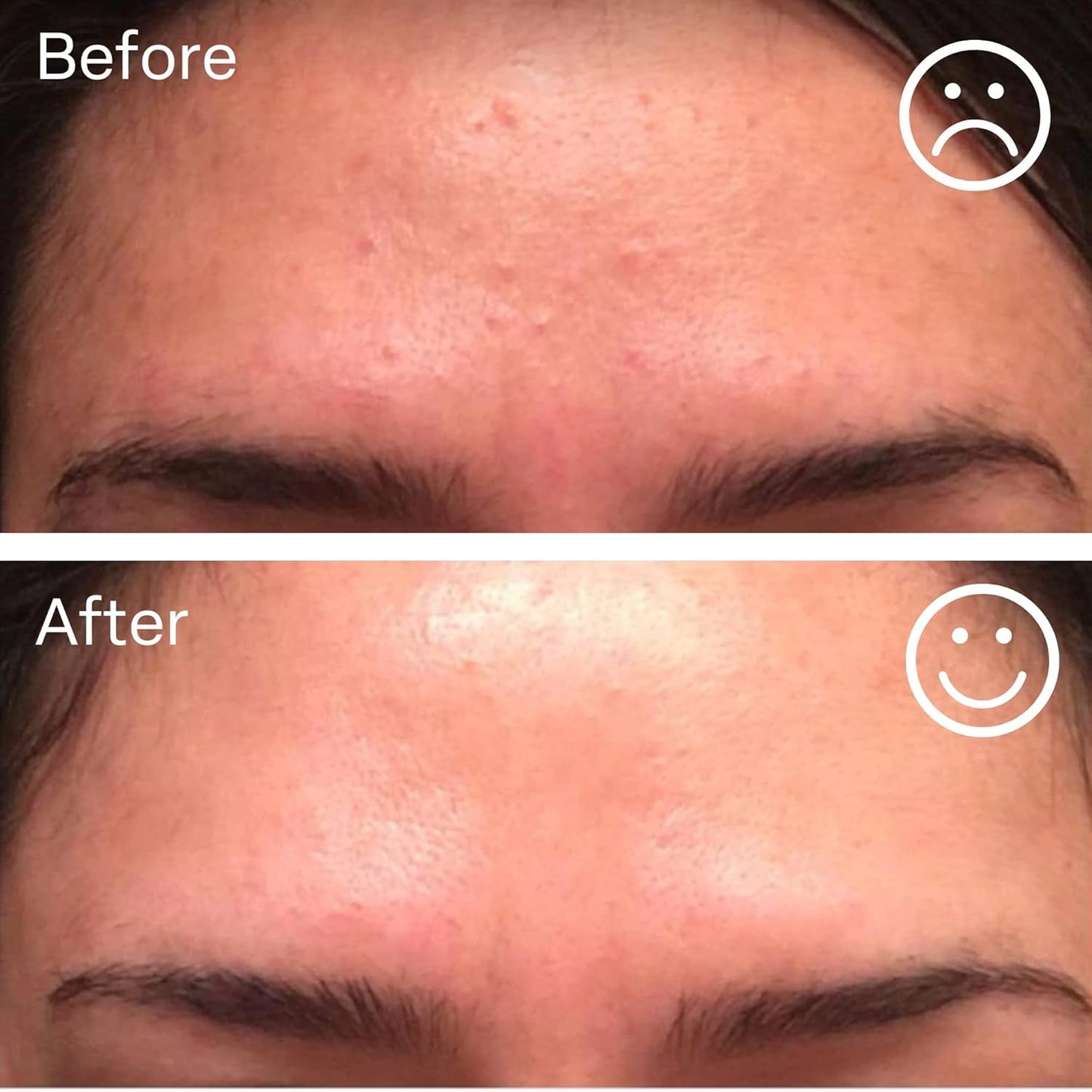 Natural Anti Aging Hyaluronic Acid Face Serum