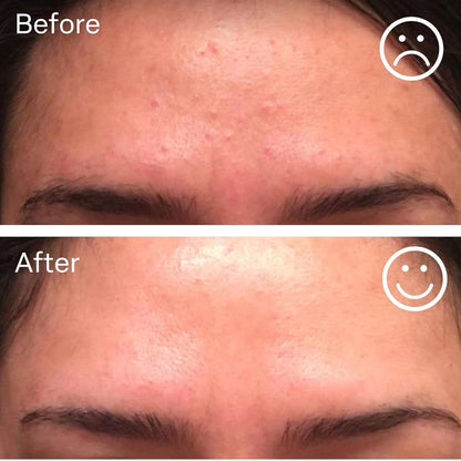 Natural Anti Aging Hyaluronic Acid Face Serum