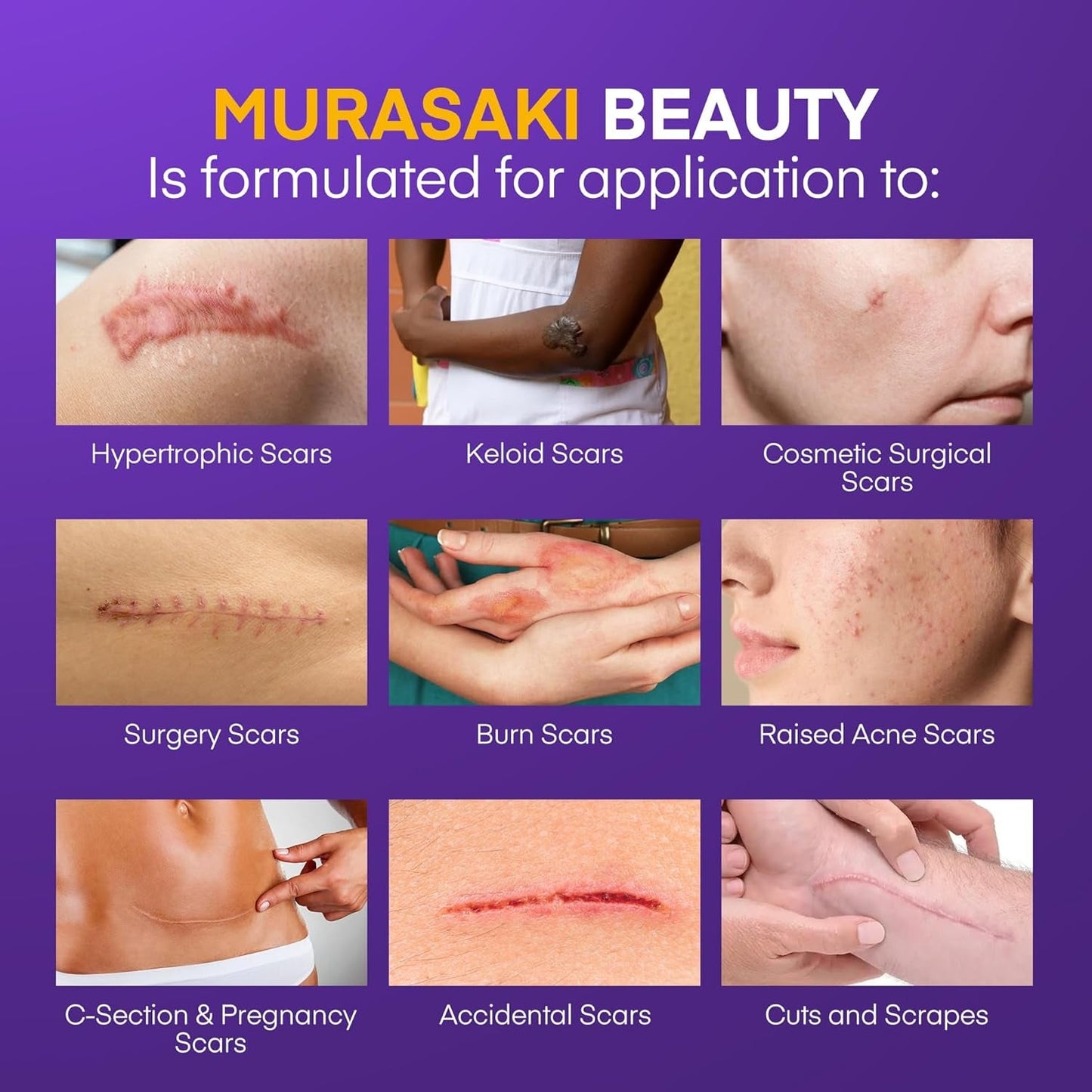 Silicone Scar Cream with SPF 30 for Sensitive Skin