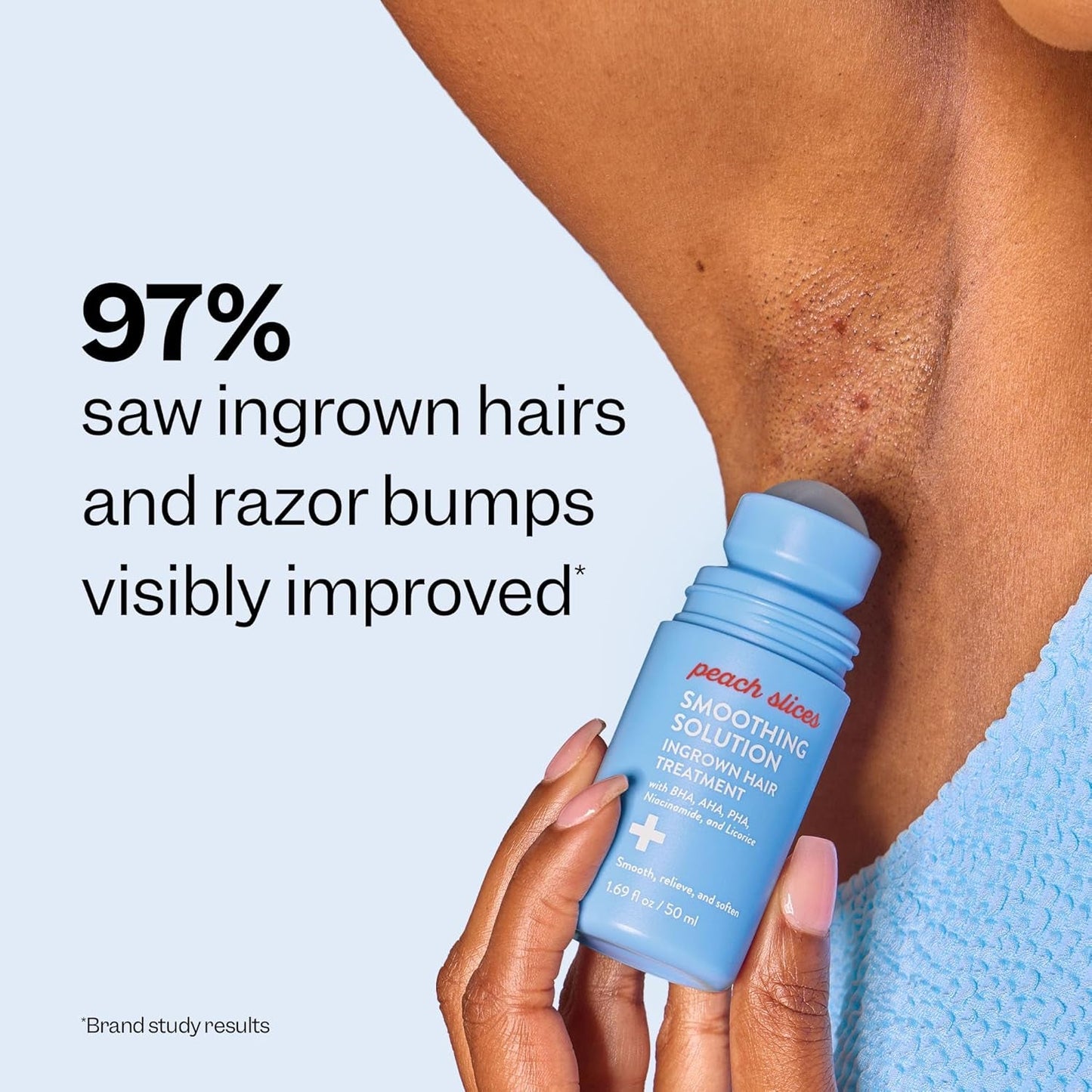 Gentle Ingrown Hair Remedy - 50ml | Reduce Bumps & Redness