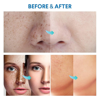 Gentle Razor Bump Treatment + Dark Spot Corrector