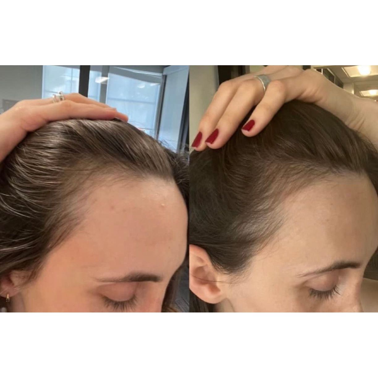 Natural Hair Growth Stimulating Oil 50ml