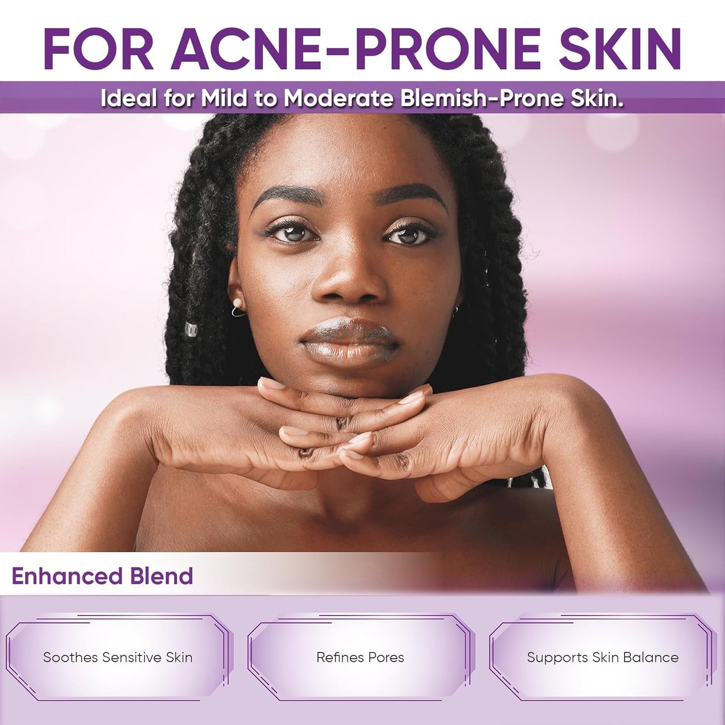 Natural Acne & Redness Relief Face Serum 30ml