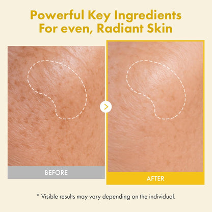 Natural Kojic Acid Brightening Face Mask 50ml