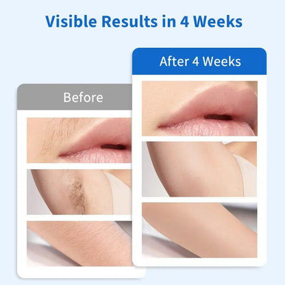 Painless At-Home Hair Remover with Cooling System