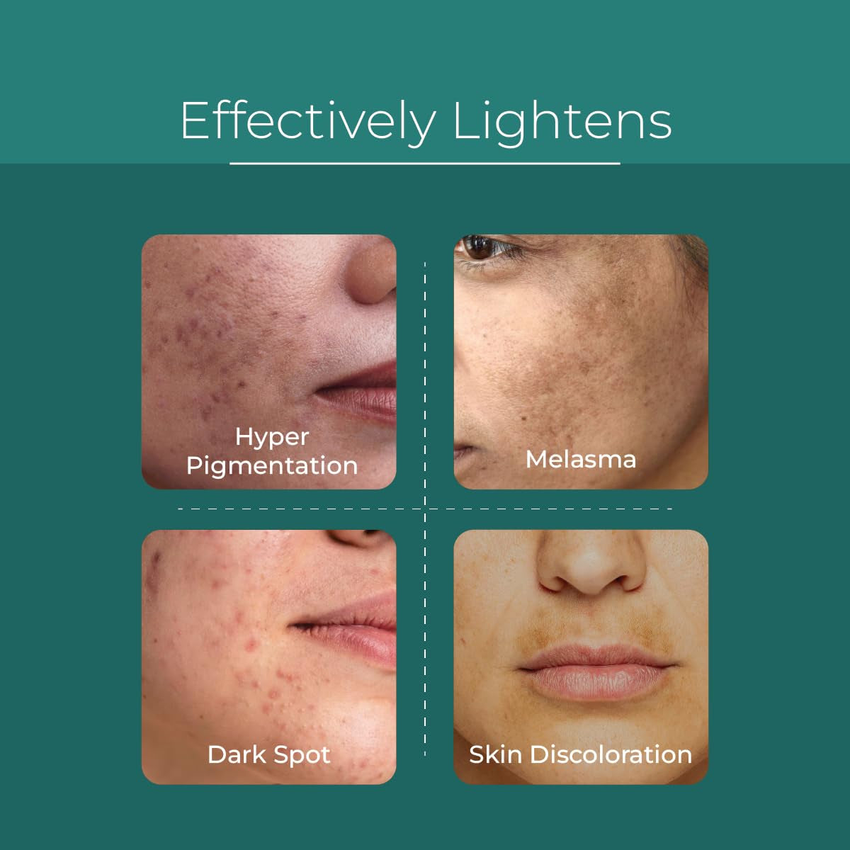Natural Glow Dark Spot Serum 30ml