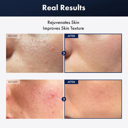 Intensive Snail Essence 100ml - Moisturizing Glow Serum