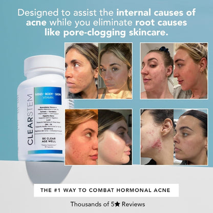 Natural Vitamin for Acne Relief and Mood Support Capsules
