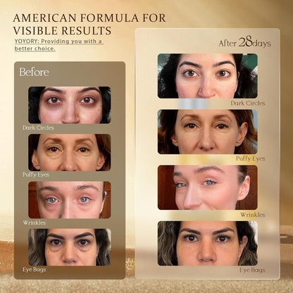 Anti Aging Eye Cream - 20ml | Wrinkle Reducing & Smoothing
