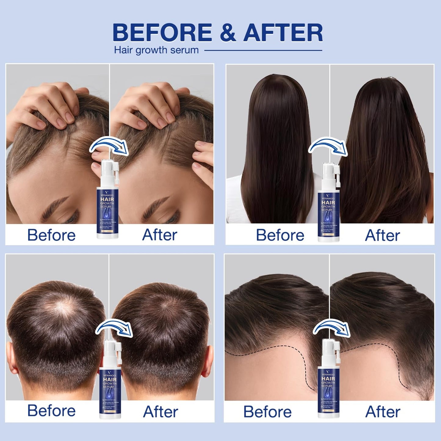 Nourishing Hair Thickening Serum 60ml