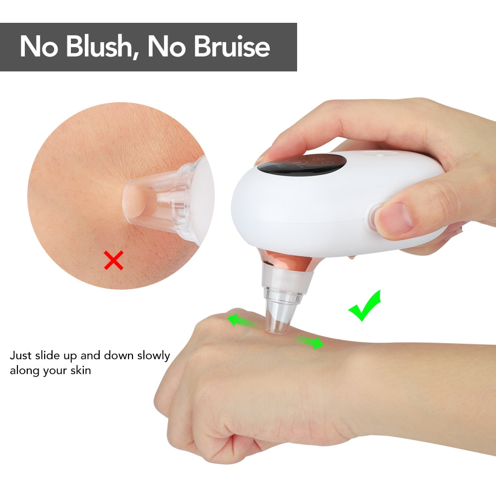 Pore Cleansing Vacuum & Exfoliating Skin Refresher Device