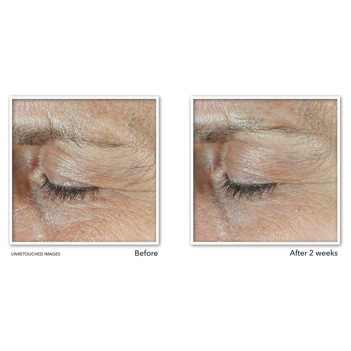 Anti Aging Eye Cream with Retinol and Peptides