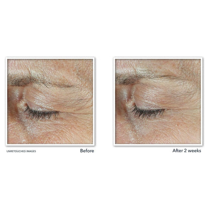 Anti Aging Eye Cream with Retinol and Peptides